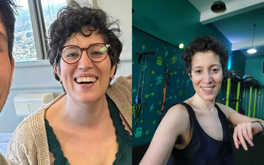 antes e depois · Carol