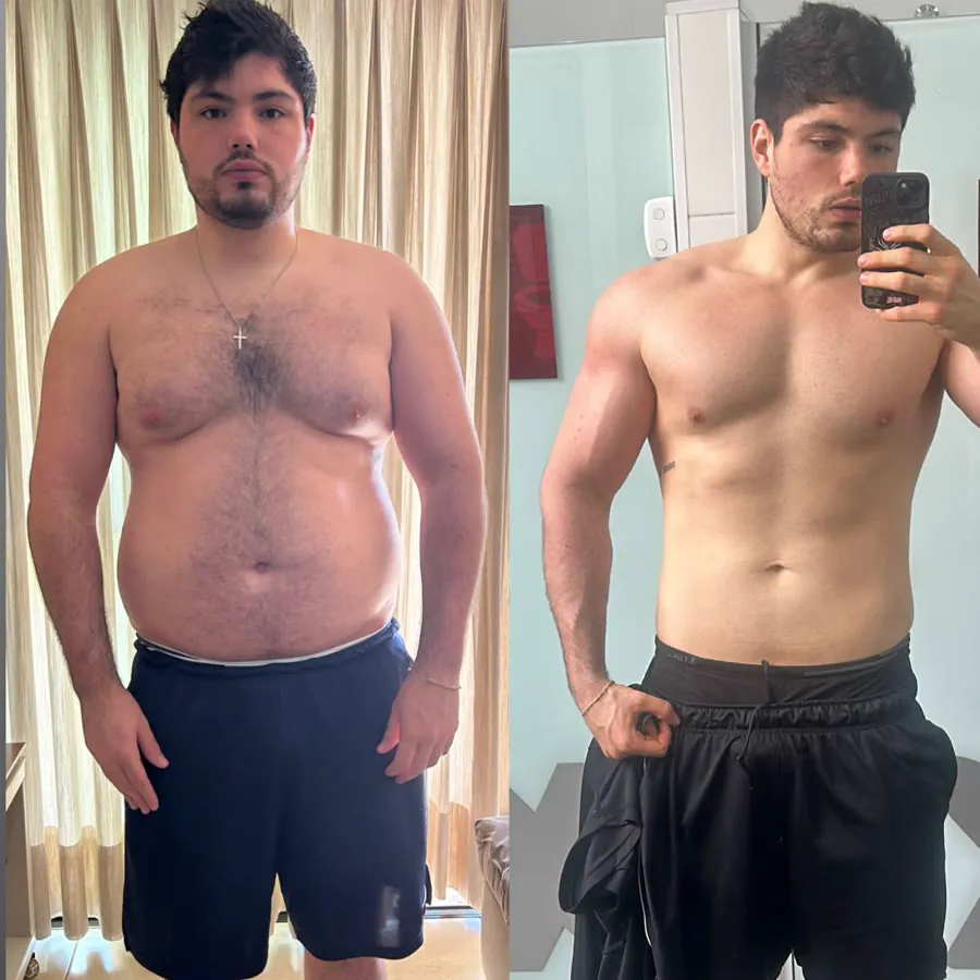 Antes e depois do Dr. Leonardo Passarelli