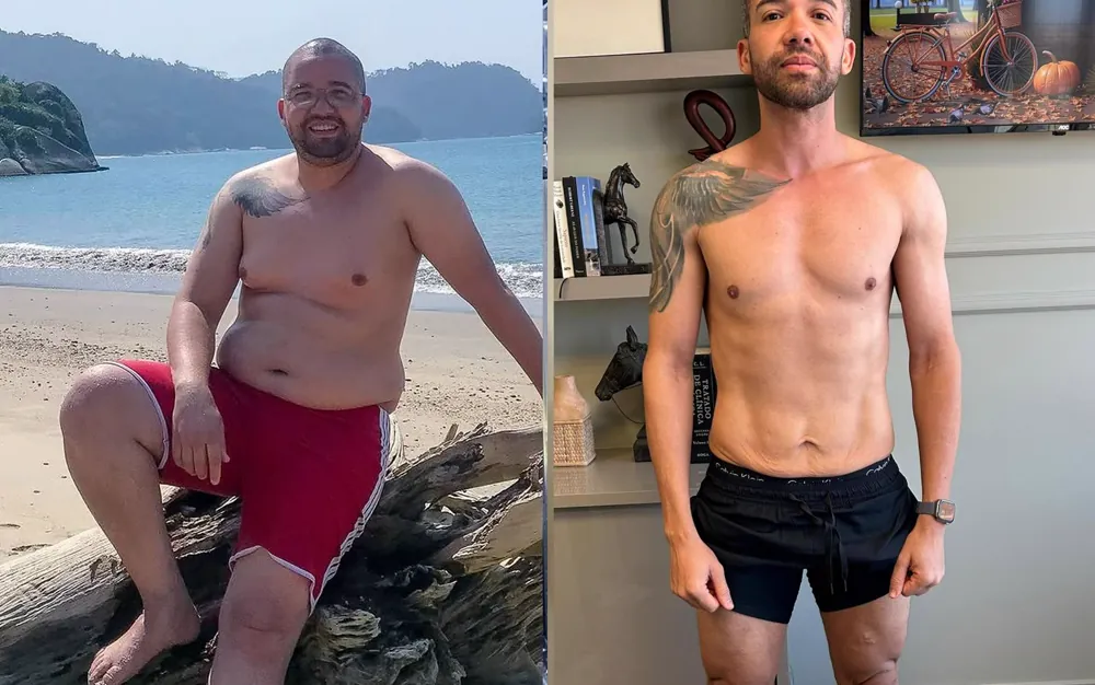 antes e depois · Marcelo