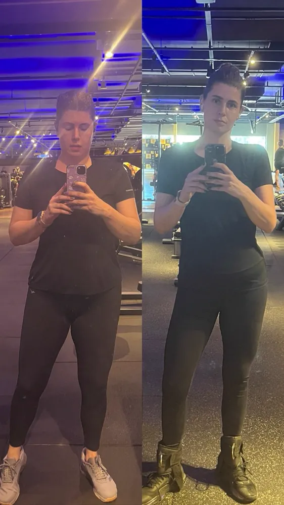 antes e depois · Mikelli