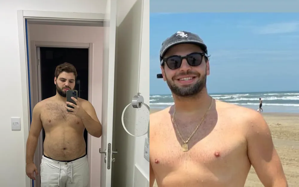 antes e depois · Pedro